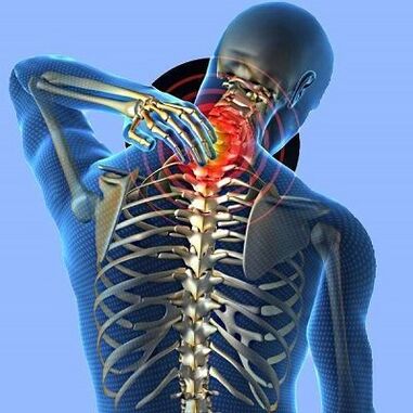 Douleurs au cou avec l'ostéochondose cervicale