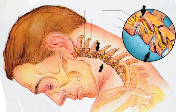La structure des vertèbres cervicales