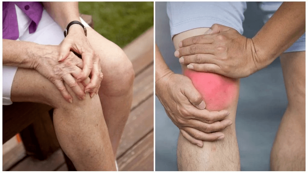 Traitement de l'arthrose